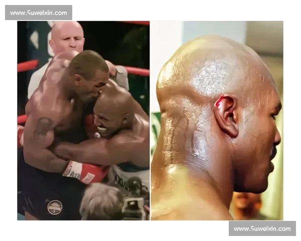 铁拳与王者的未竟对决泰森对里迪克鲍的时代想象拳击历史回望一战